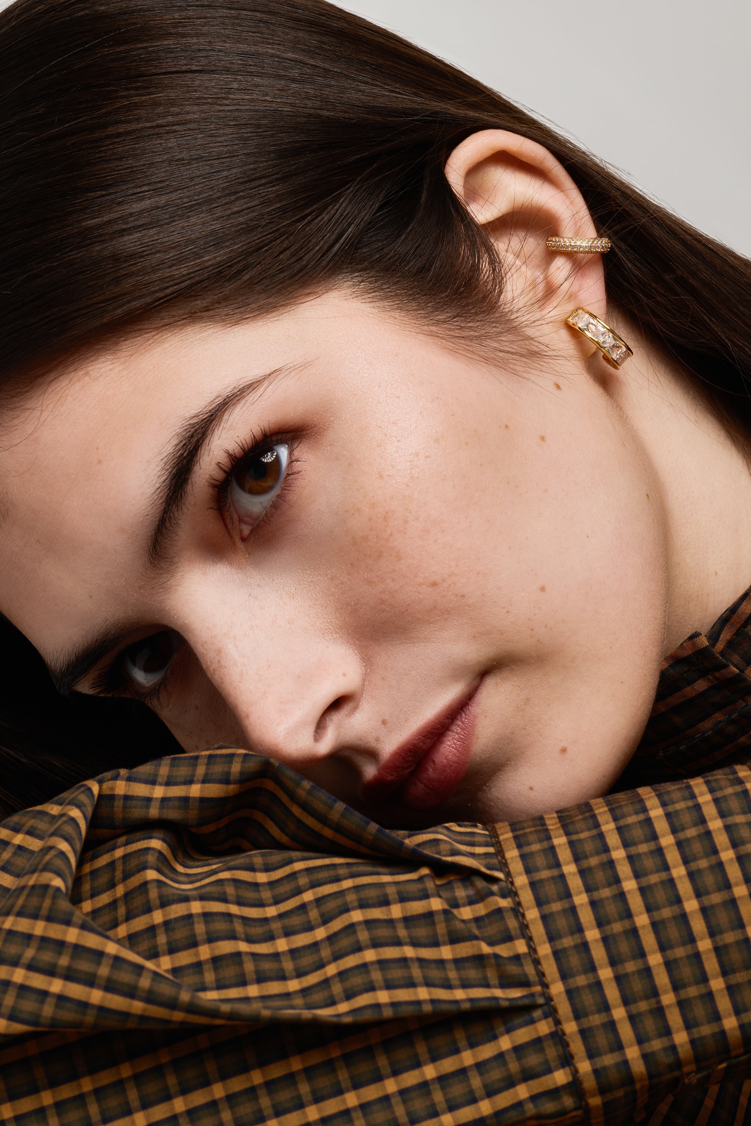 Metal Allergies & Keloid Scars? Here’s Why Aiori Clip-On Earrings Are Your Best Choice